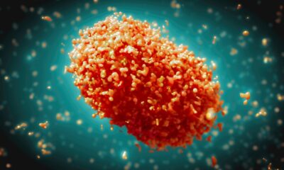 Mpox: Symptoms, Transmission, and Prevention Strategies