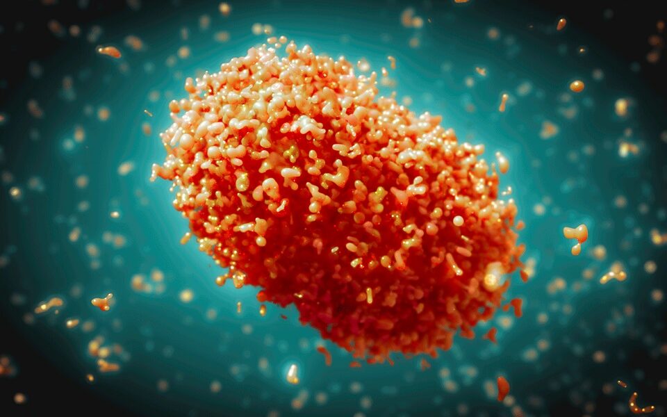 Mpox: Symptoms, Transmission, and Prevention Strategies