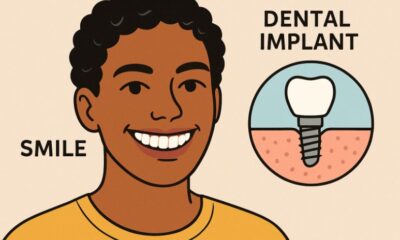 Dental Implants