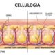Cellulogia: How It Affects Our Bodies and Well-Being