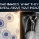 Diag Images: What They Reveal About Your Health