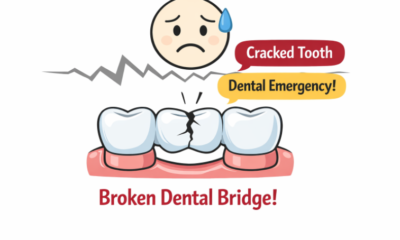 Dental Bridge
