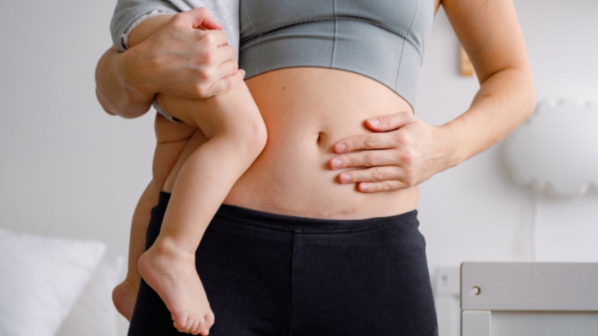 Pregnancy to Recovery