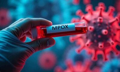 Mpox: How to Heal Skin Without Marks
