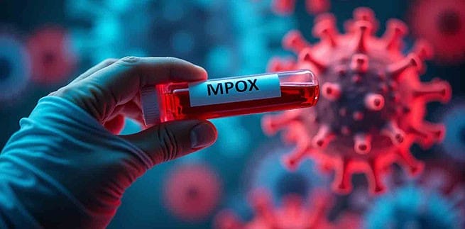 Mpox: How to Heal Skin Without Marks