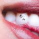Tooth Gems 101