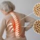Osteopur: Ultimate Supplement for Strong Bones